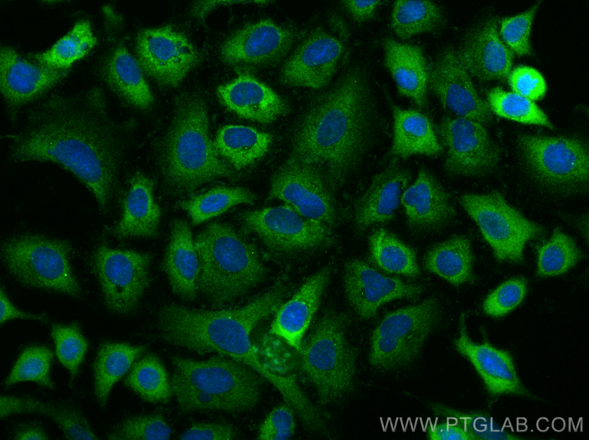 IF Staining of A549 using 24594-1-AP