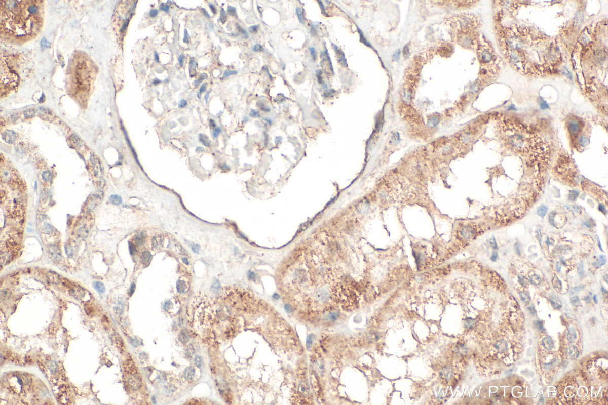 IHC staining of human kidney using 24594-1-AP
