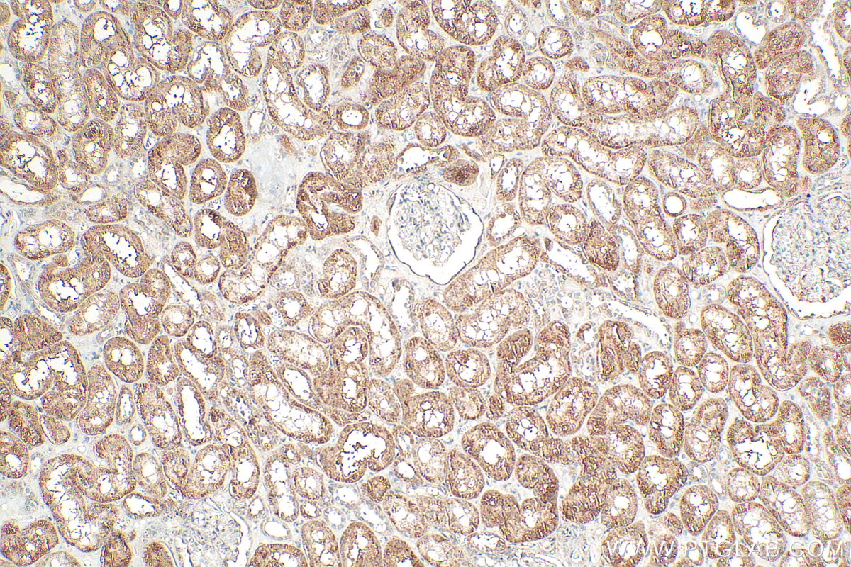 IHC staining of human kidney using 24594-1-AP