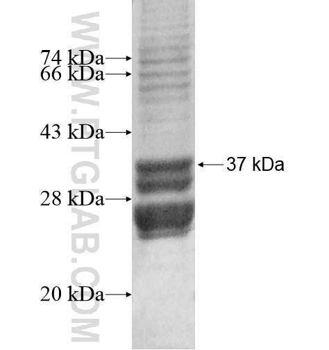 TTC39A fusion protein Ag14340 SDS-PAGE TTC39A fusion protein Ag14340 SDS-PAGE