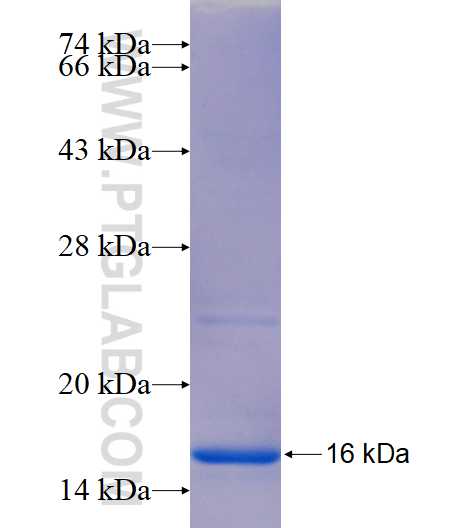 TTC39A fusion protein Ag14874 SDS-PAGE TTC39A fusion protein Ag14874 SDS-PAGE
