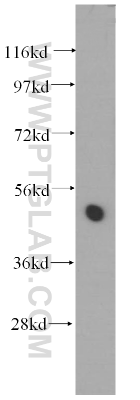 WB analysis of HeLa using 11878-1-AP