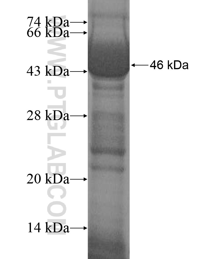TTC6 fusion protein Ag17277 SDS-PAGE TTC6 fusion protein Ag17277 SDS-PAGE