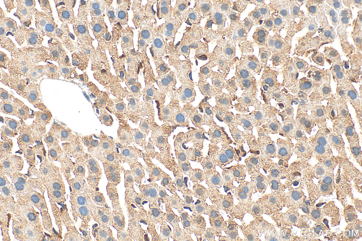 IHC staining of mouse liver using 25713-1-AP