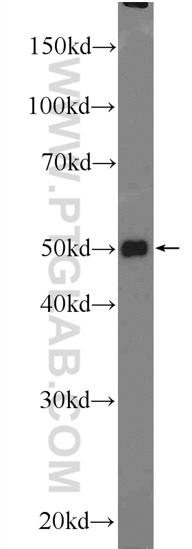 WB analysis of mouse liver using 25713-1-AP