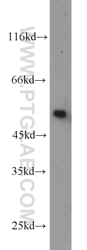 WB analysis of mouse testis using 12505-1-AP