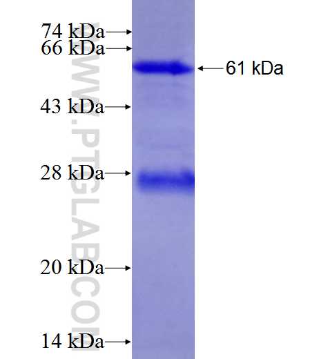 TTC8 fusion protein Ag3186 SDS-PAGE
