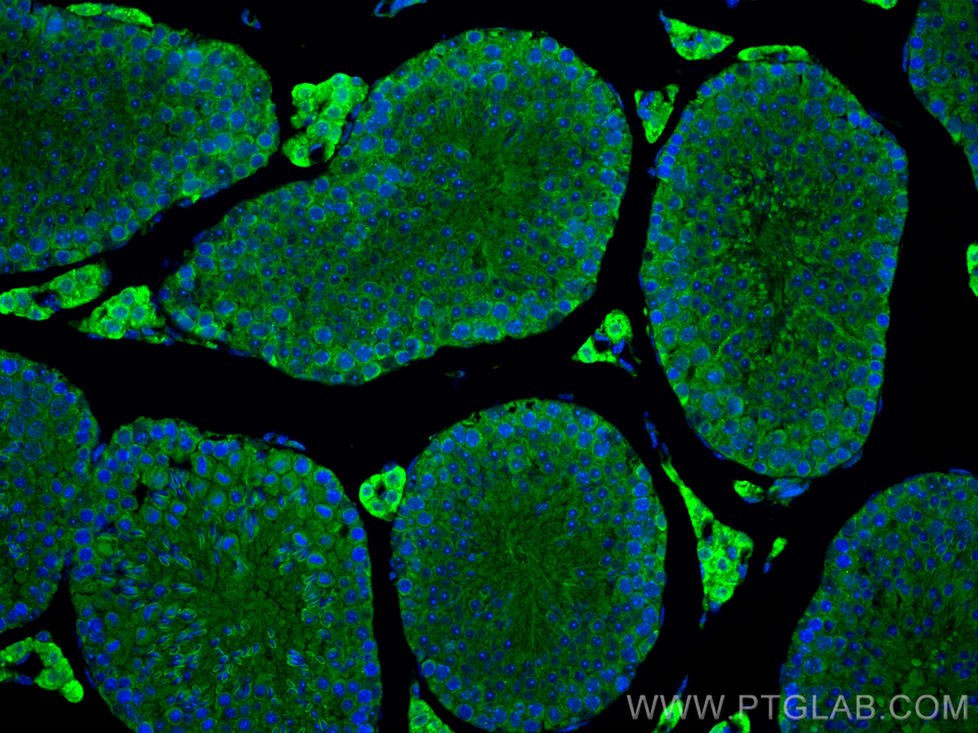 IF Staining of mouse testis using 31797-1-AP
