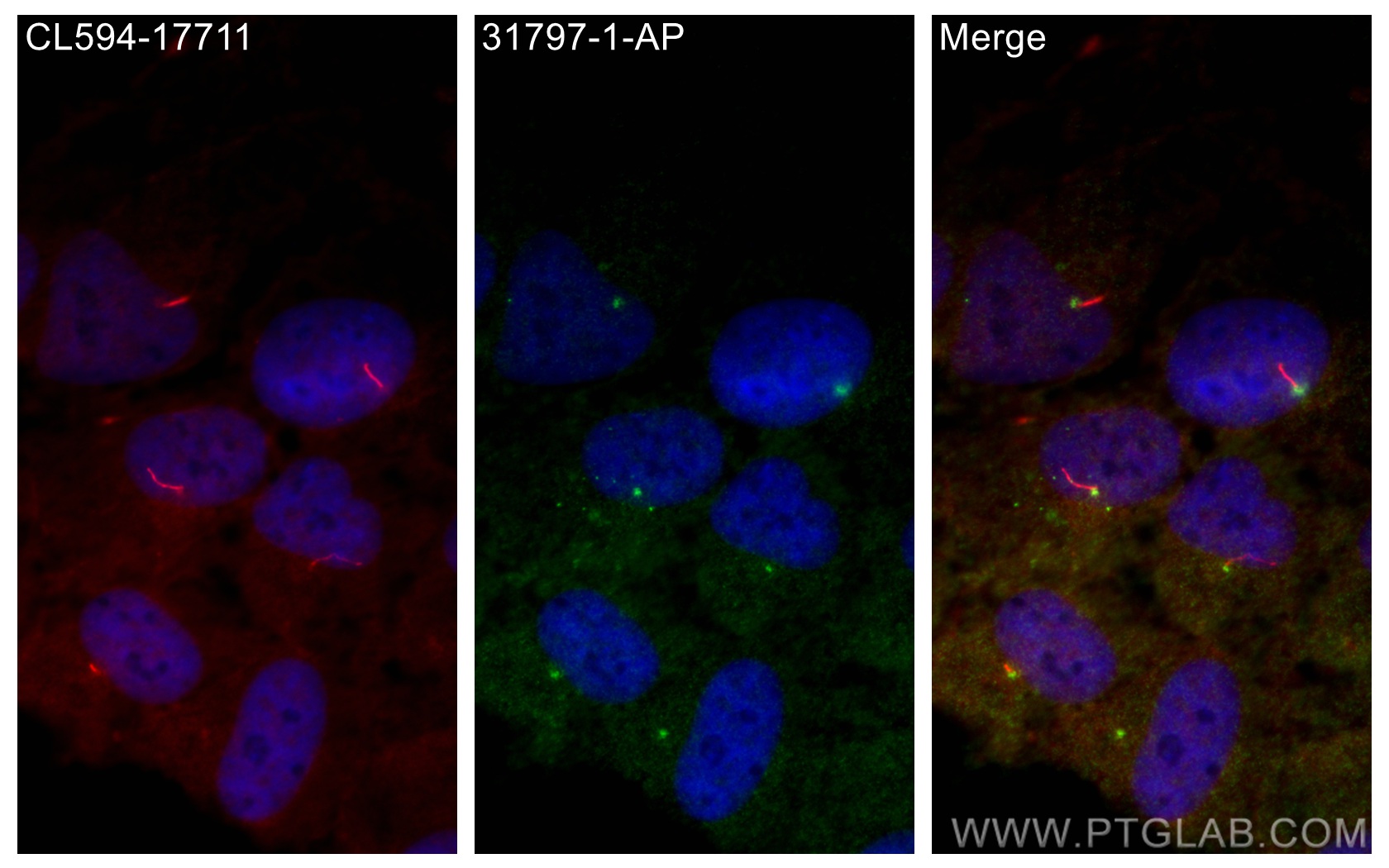 IF Staining of hTERT-RPE1 using 31797-1-AP