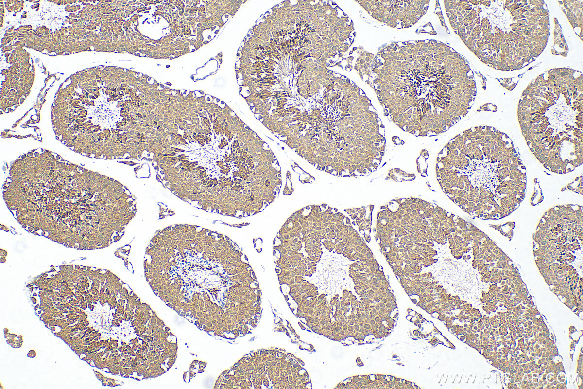 IHC staining of mouse testis using 31797-1-AP