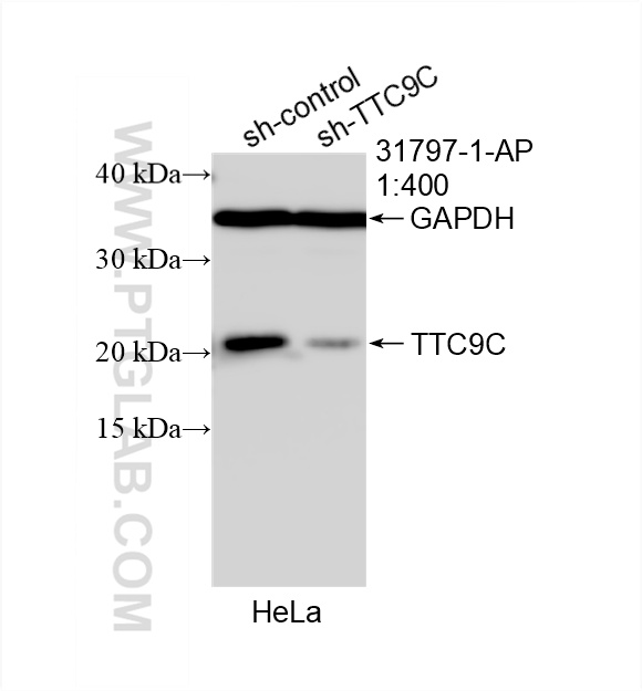WB analysis of HeLa using 31797-1-AP
