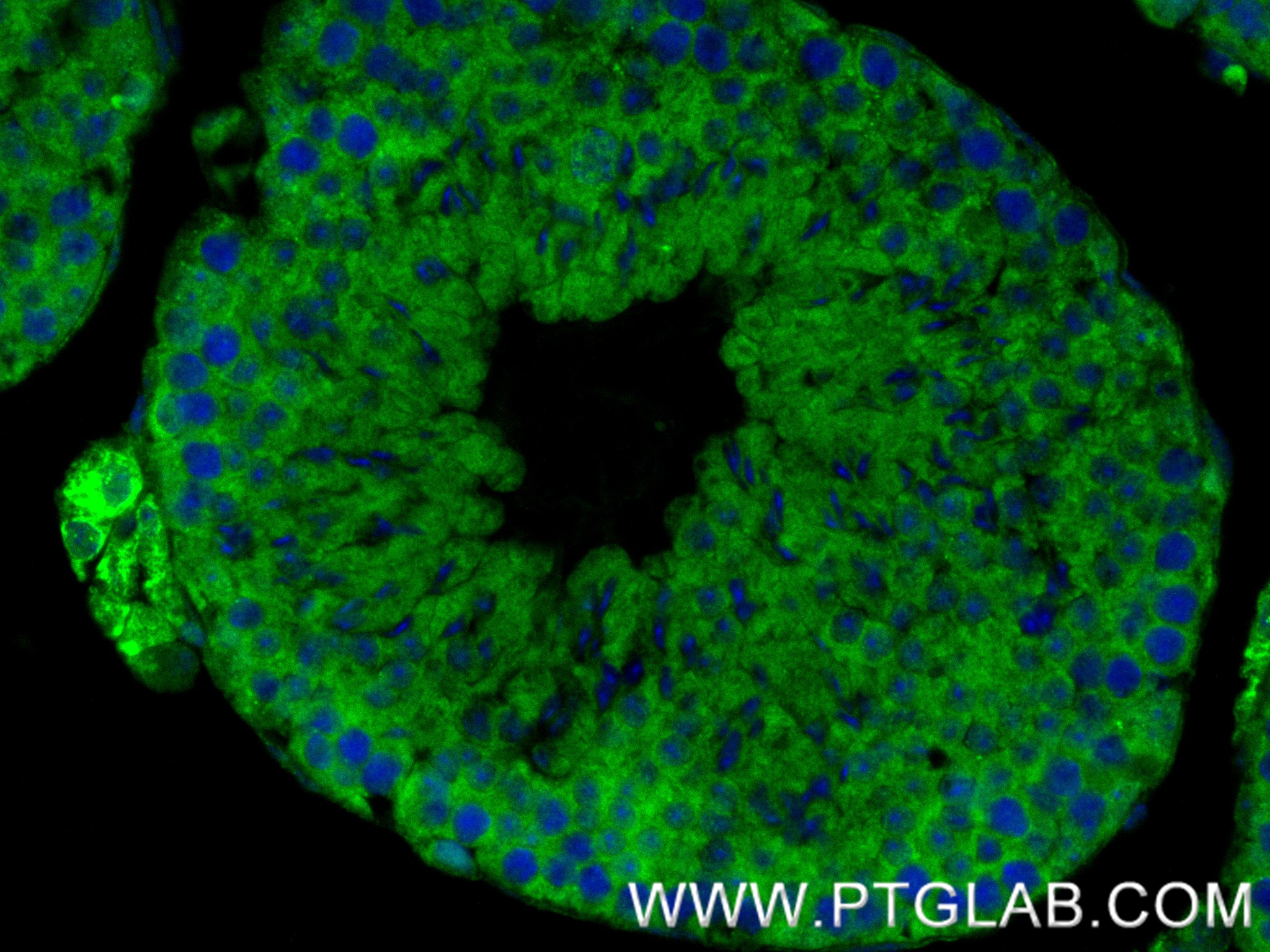 IF Staining of mouse testis using 84611-2-RR (same clone as 84611-2-PBS)