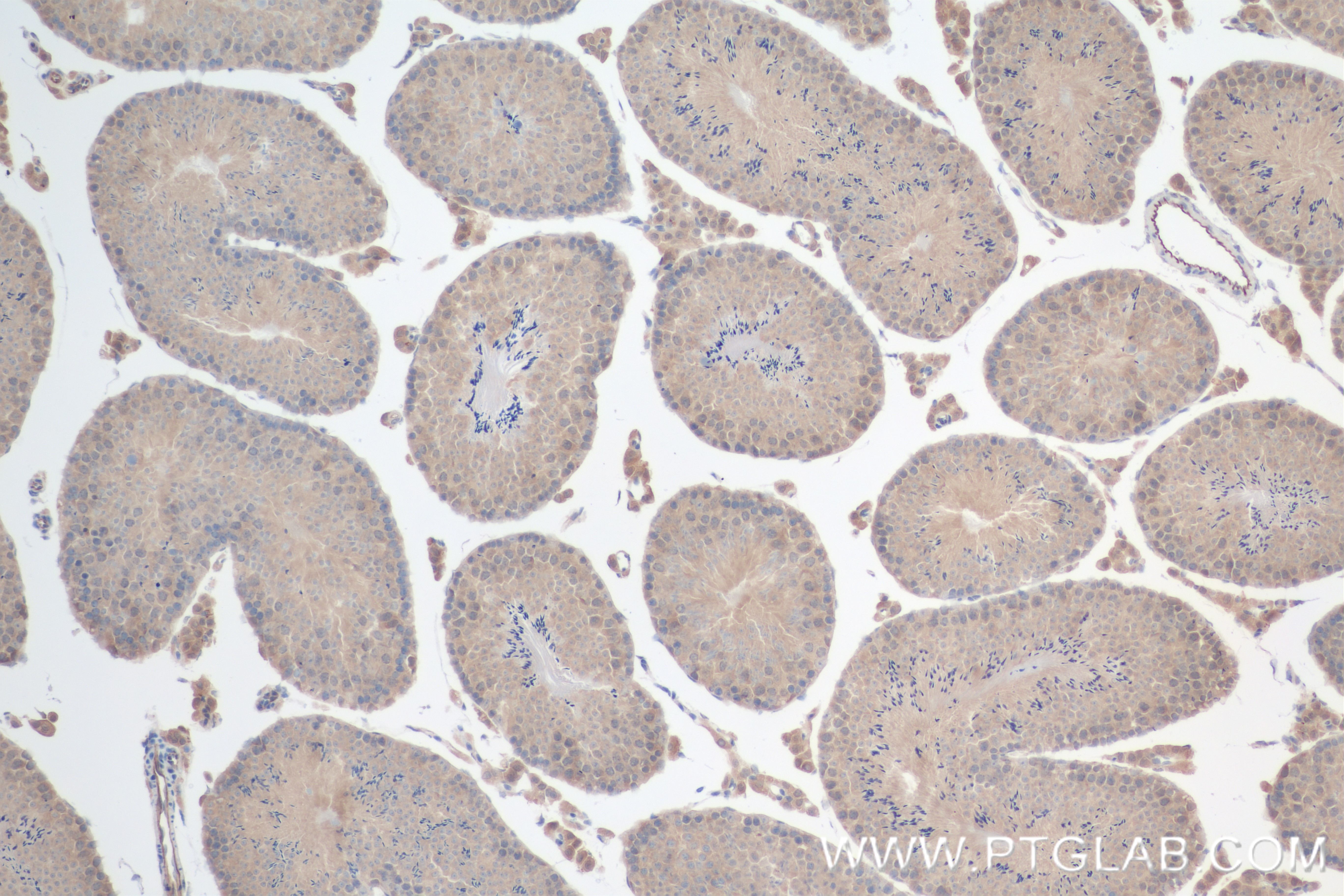 IHC staining of mouse testis using 84611-2-RR