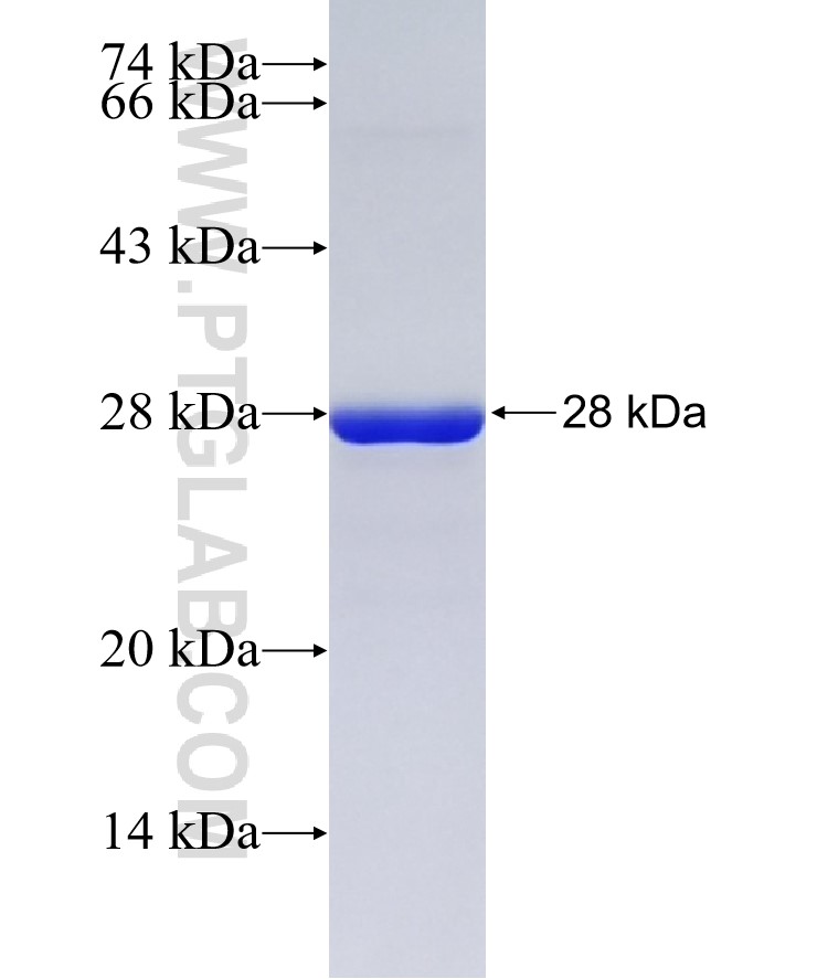TTC9C fusion protein Ag37522 SDS-PAGE
