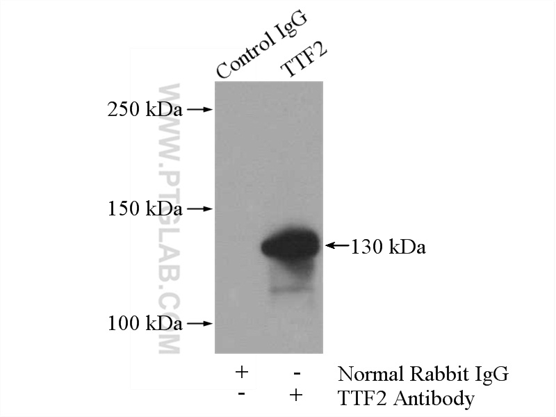 IP experiment of A2780 using 13722-1-AP