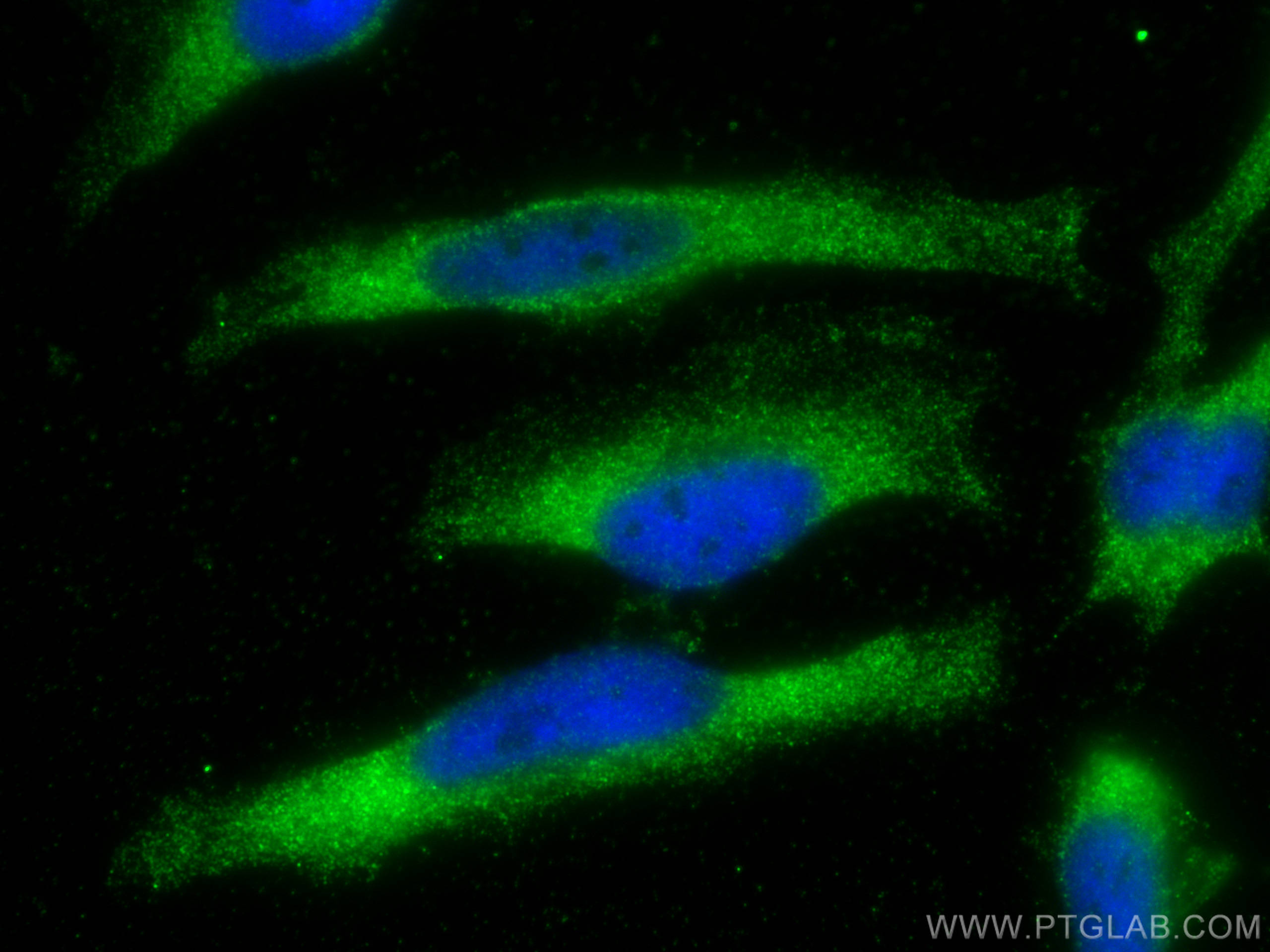 IF Staining of HeLa using 10381-1-AP