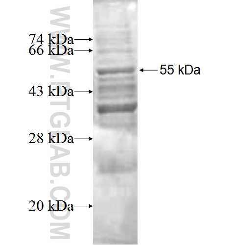 TTK fusion protein Ag0405 SDS-PAGE
