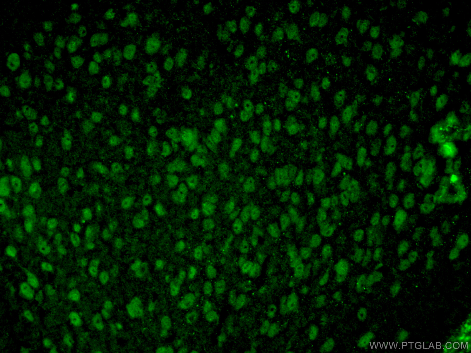 IF Staining of mouse brain using 13618-1-AP