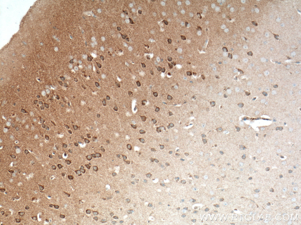 IHC staining of mouse brain using 13618-1-AP