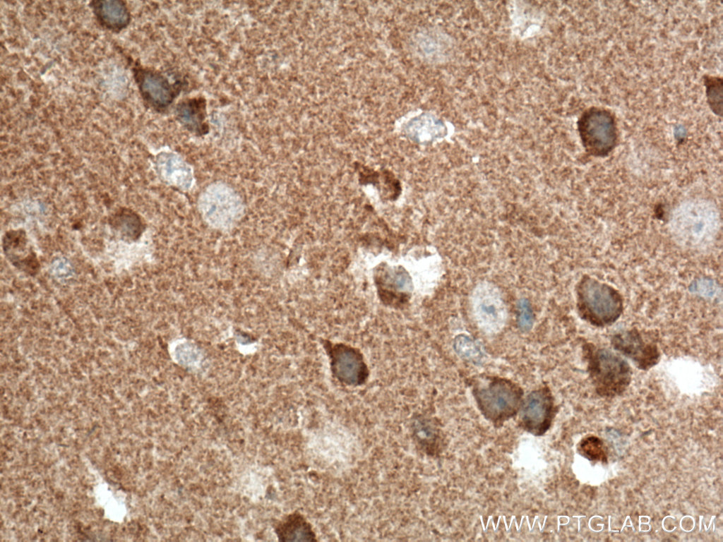 IHC staining of mouse brain using 13618-1-AP