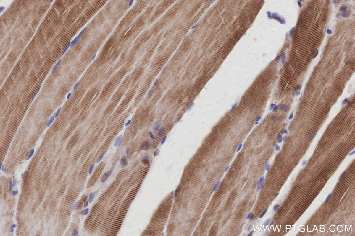 IHC staining of rat skeletal muscle using 13618-1-AP IHC staining of rat skeletal muscle using 13618-1-AP