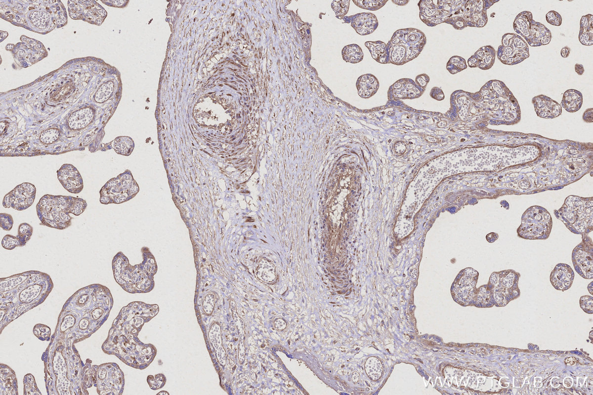 IHC staining of human placenta using 13618-1-AP IHC staining of human placenta using 13618-1-AP
