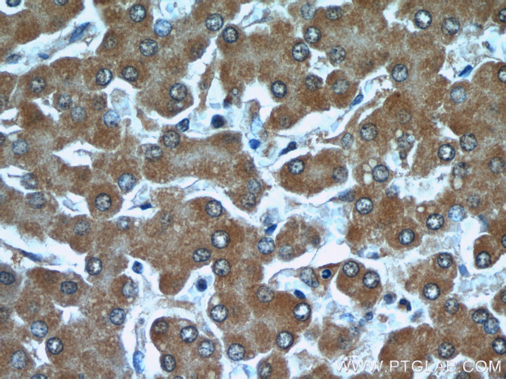 IHC staining of human liver using 66076-1-Ig