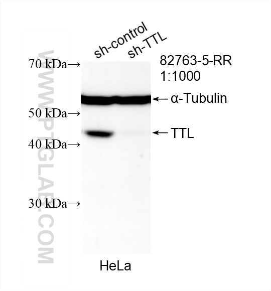 TTL
