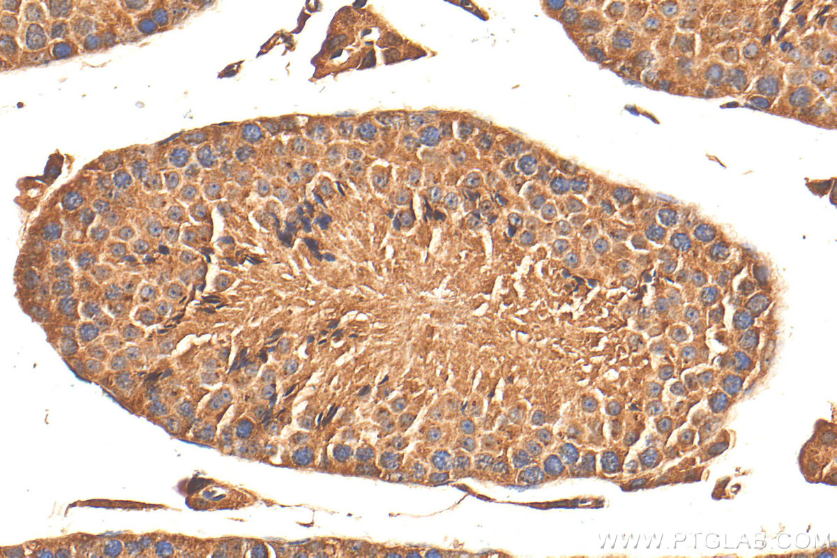 IHC staining of mouse testis using 21447-1-AP
