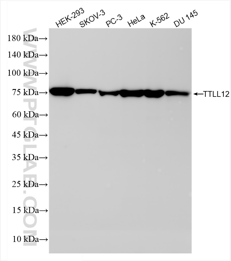 WB analysis using 84493-6-RR (same clone as 84493-6-PBS)