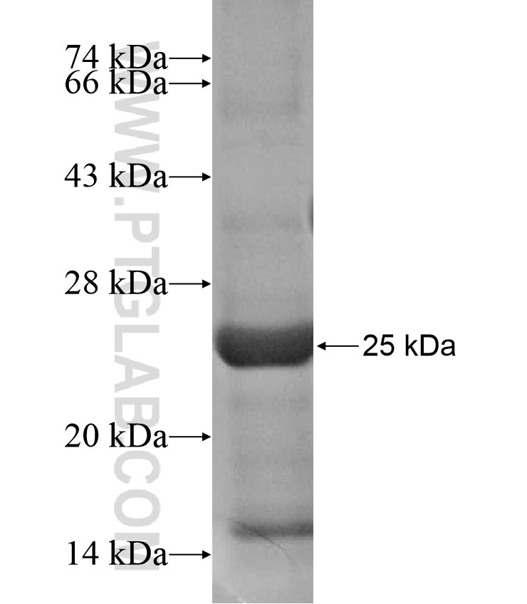 TTLL3 fusion protein Ag17021 SDS-PAGE TTLL3 fusion protein Ag17021 SDS-PAGE