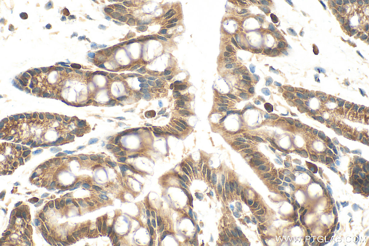 IHC staining of mouse colon using 11891-1-AP