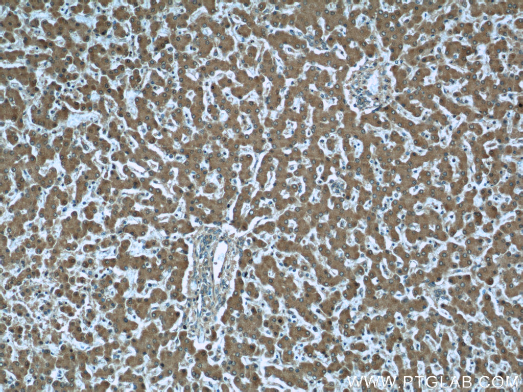 Prealbumin/transthyretin