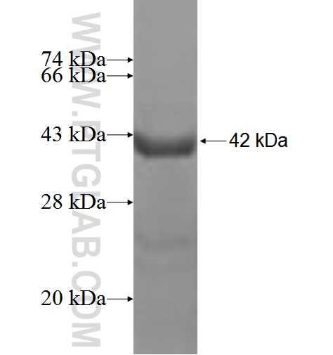 TTR fusion protein Ag2499 SDS-PAGE