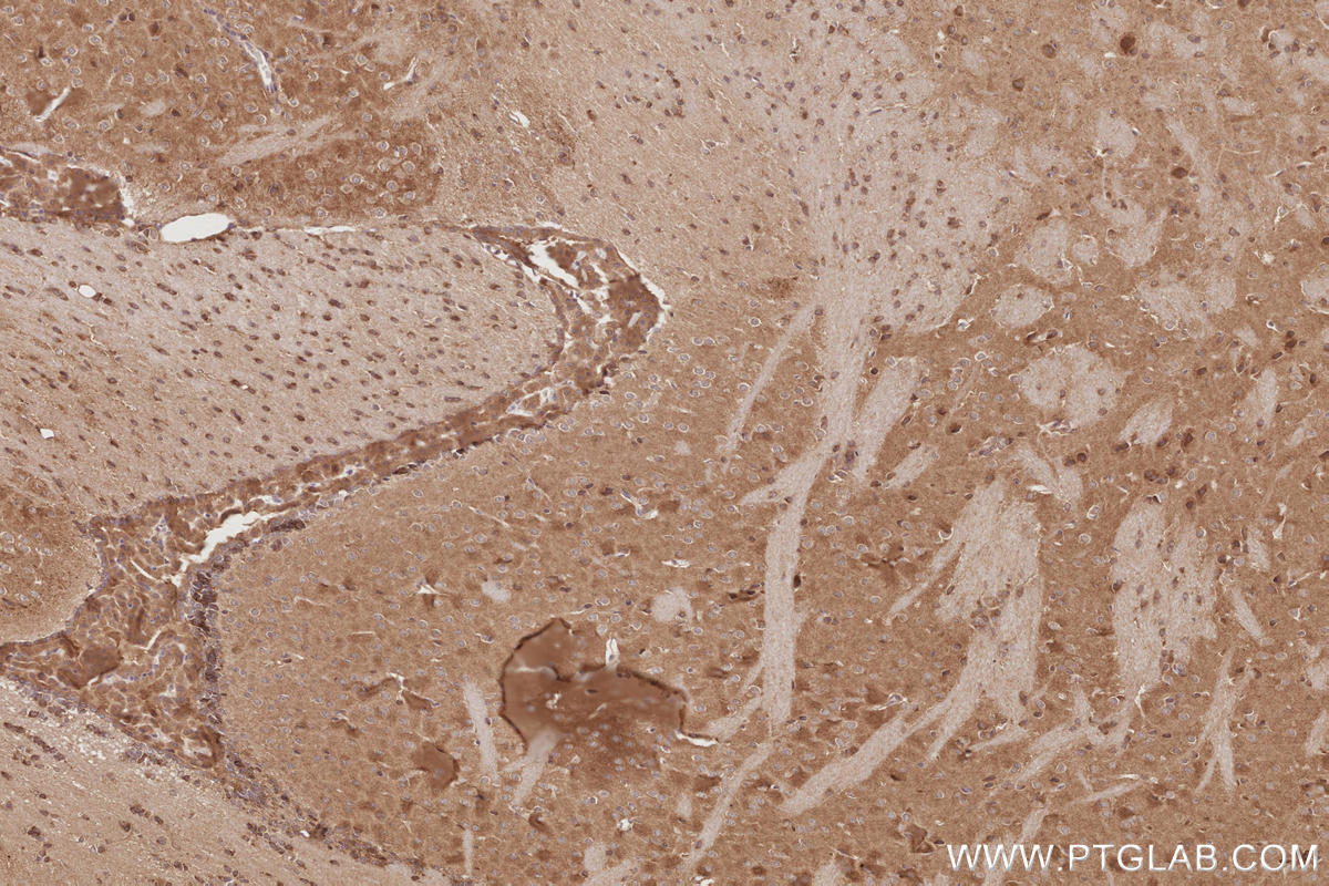 IHC staining of mouse brain using 26973-1-AP IHC staining of mouse brain using 26973-1-AP