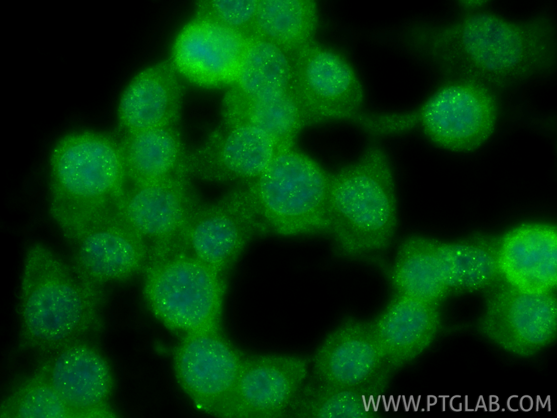 IF Staining of Neuro-2a using 17928-1-AP IF Staining of Neuro-2a using 17928-1-AP
