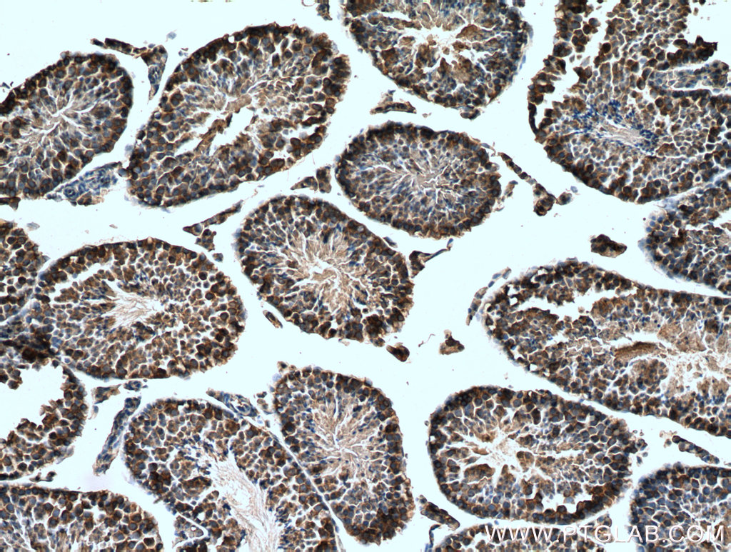 IHC staining of mouse testis using 14555-1-AP