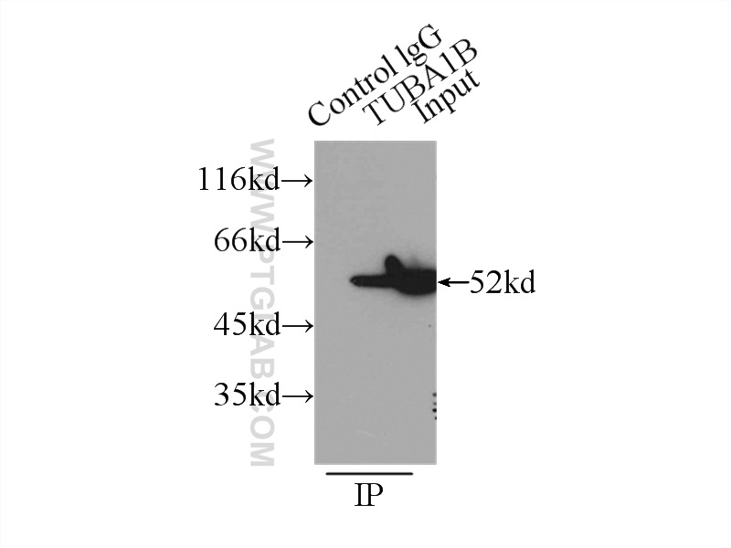 IP experiment of HeLa using 11224-1-AP