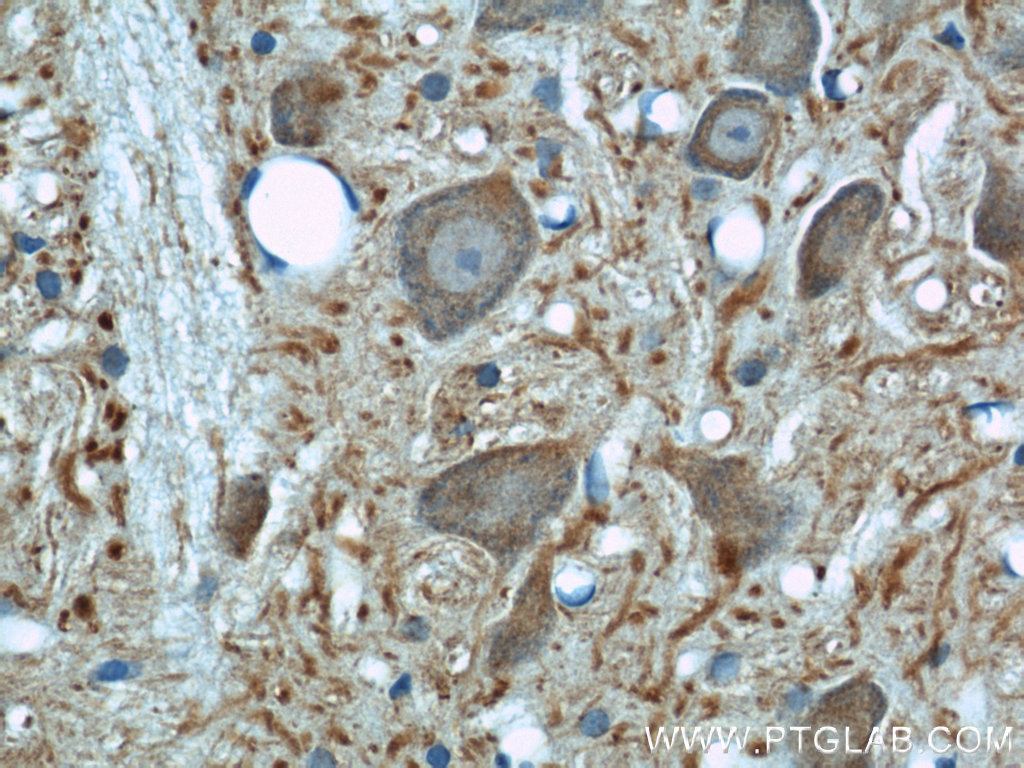 IHC staining of rat brain using 10094-1-AP