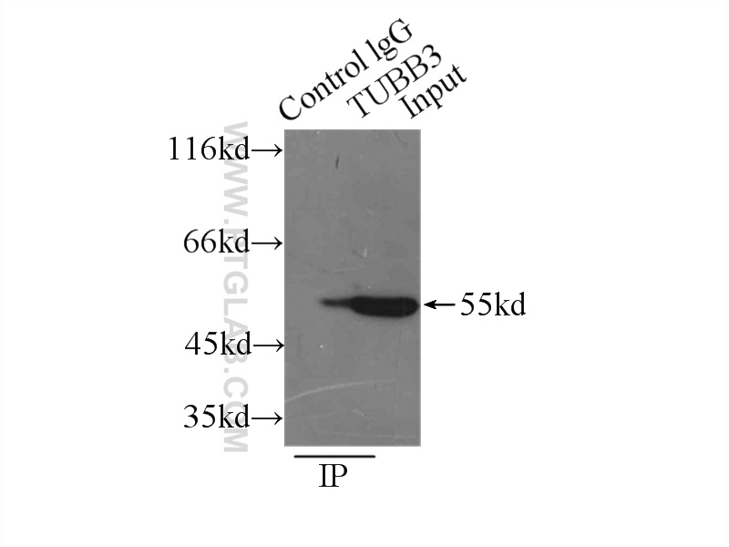 IP experiment of mouse brain using 10094-1-AP