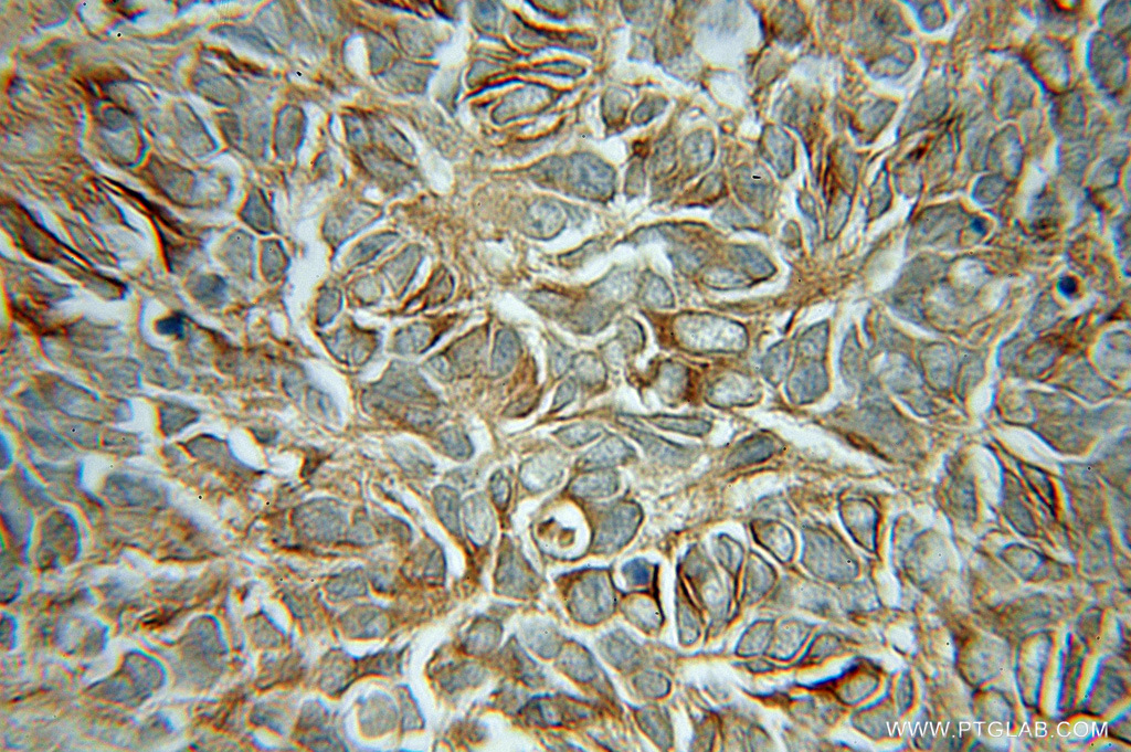 Beta Tubulin