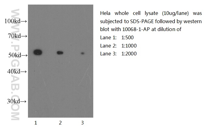 Beta Tubulin