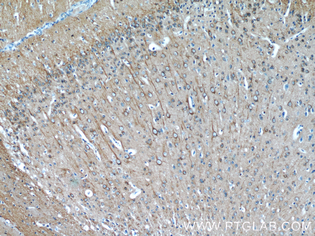 IHC staining of mouse brain using 10068-1-AP