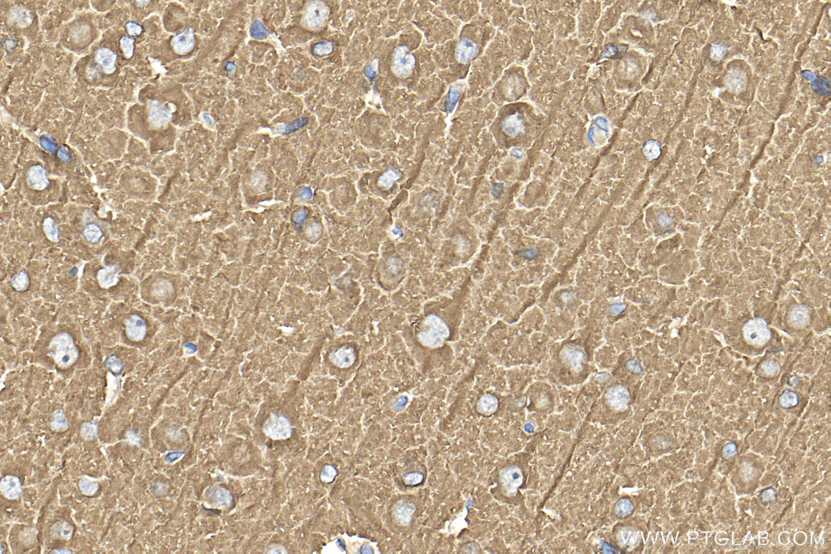 IHC staining of rat brain using 10068-1-AP