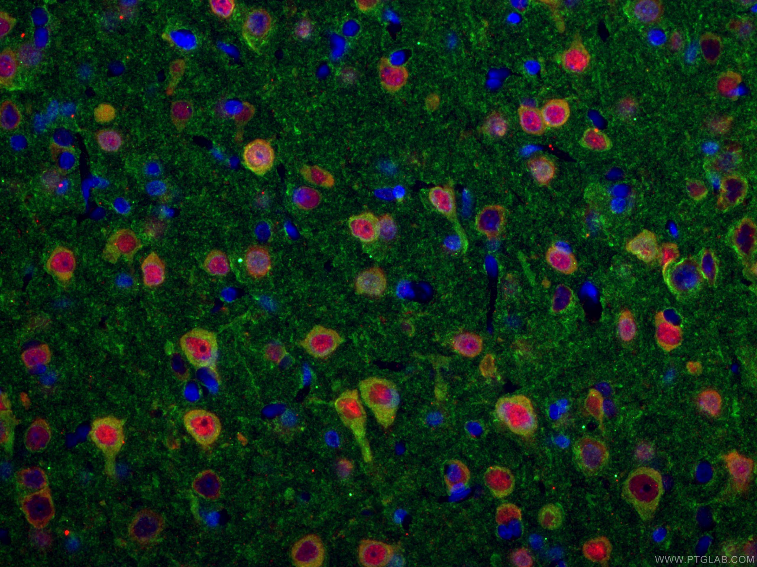 IF Staining of rat brain using 66375-1-Ig (same clone as 66375-1-PBS)