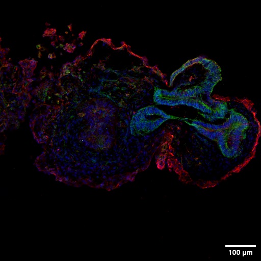 IF Staining of Retinal organoids using 66375-1-Ig