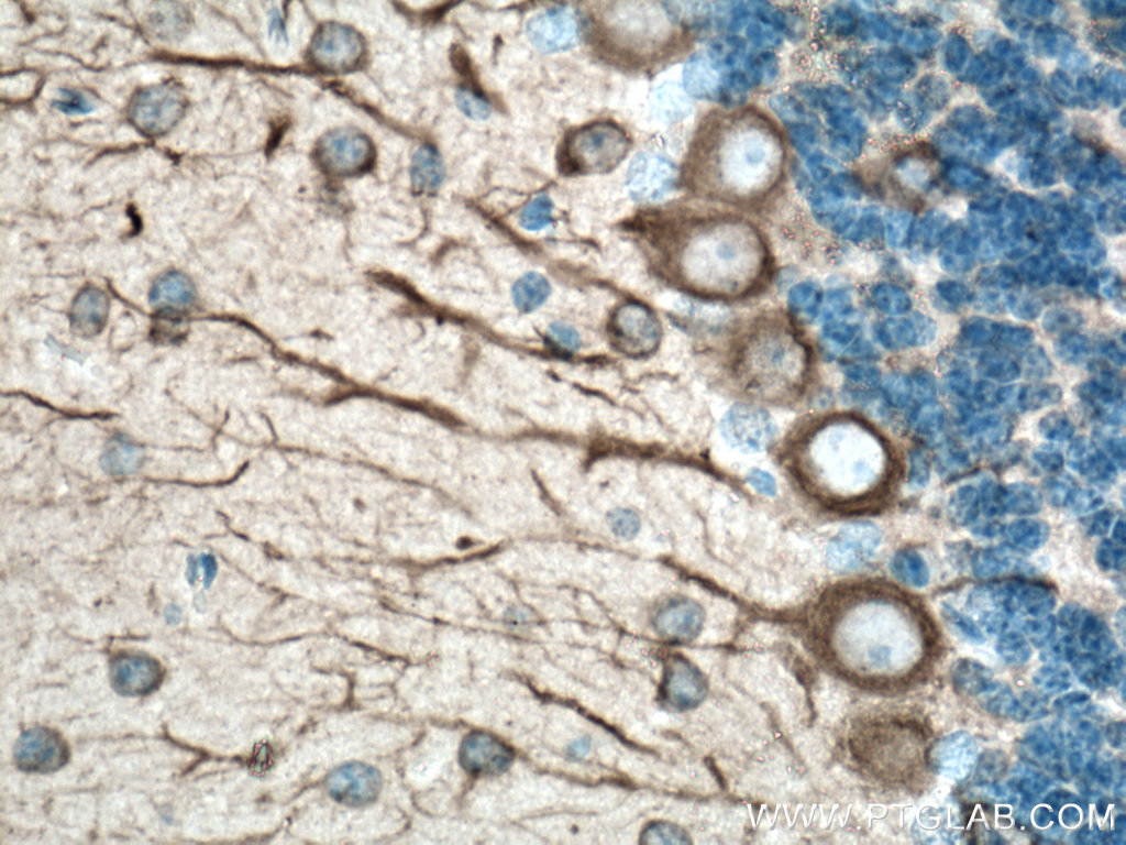 IHC staining of mouse brain using 66375-1-Ig (same clone as 66375-1-PBS)