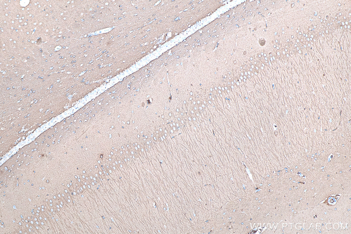 IHC staining of rat brain using 66375-1-Ig IHC staining of rat brain using 66375-1-Ig