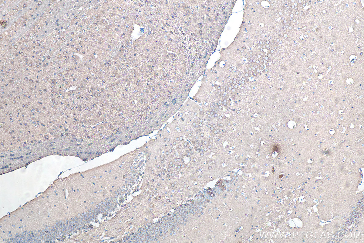 IHC staining of mouse brain using 66375-1-Ig IHC staining of mouse brain using 66375-1-Ig