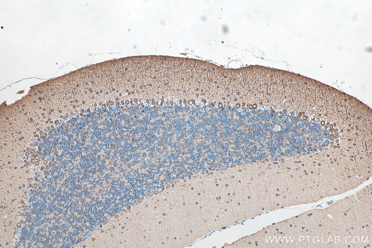 IHC staining of mouse cerebellum using 66375-1-Ig IHC staining of mouse cerebellum using 66375-1-Ig